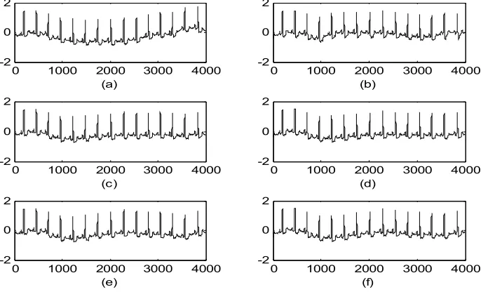 Figure 3: PLI  Filtering results:    a) Filtering  with LMS,  b) Filtering  with MLMS,  c) Filtering  with NMLMS,  d) Filtering  with NSRMLMS, e) Filtering  with NSMLMS,  f) Filtering with NSSMLMS