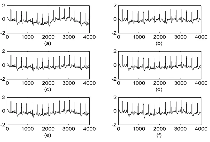 Figure 5: MA Filtering results:      a) Filtering  with LMS,  b) Filtering  with MLMS,  c) Filtering  with NMLMS,  d) Filtering  with NSRMLMS, e) Filtering  with NSMLMS,  f) Filtering with NSSMLMS