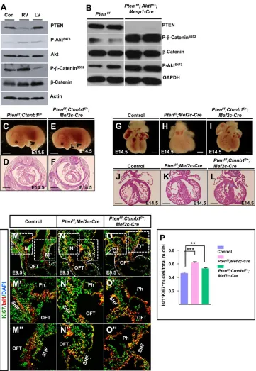 Fig. 6. PTEN-Akt signaling regulatesβmagnification views of the boxed areas inM-O. (P) Quantification of Isl1/Ki67 double-positive nuclei in M-Oin heart tissues