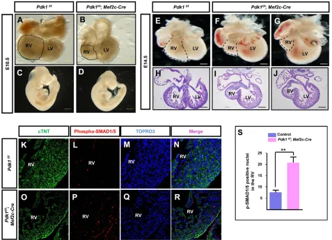 Fig. 7. Reducing Akt signaling in SHF progenitors. (A-J) Microscopic analysis of E10.5 and E14.5 hearts and embryos