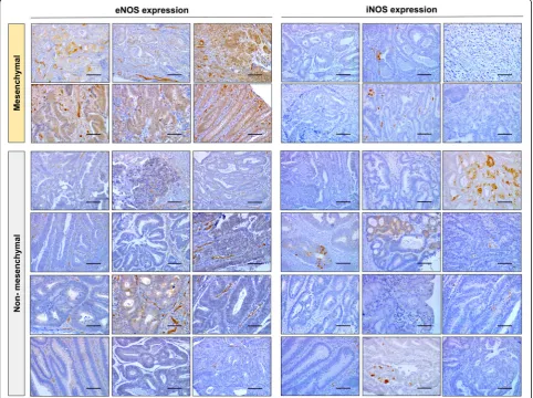 Fig. 3 eNOS and iNOS immunohistochemistry in classified human CRC tumors. eNOS is highly expressed in human mesenchymal CRC tumors.Mesenchymal tumors showed a high expression of eNOS whereas this isoenzyme was low or absent in non-mesenchymal tumors