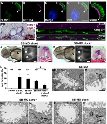 Fig. 1. ELMO1 and DOCK1 show expression in cilia in human and zebrafish and are required for ciliogenesis in zebrafish