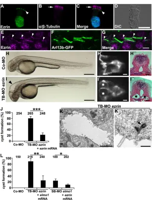 Fig. 3. Ezrin shows expression in cilia and is required for