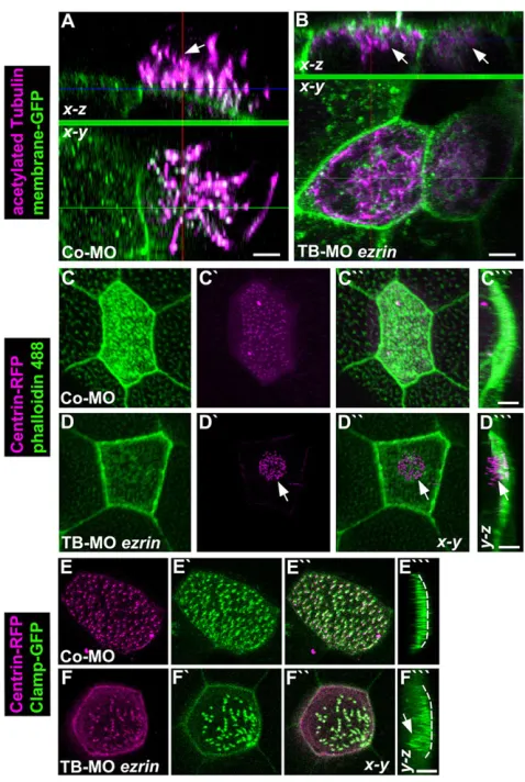 Fig. 4. Ezrin is required for ciliogenesis in Xenopuspartial basal body docking (arrow) and irregular basal body spacing comparedwith proper apically docked and evenly distributed basal bodies in embryos(stage 32) injected with Co-MO (4 ng) (E-Eembryos (st