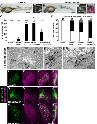 Fig. 6. Rac1 is required for ciliogenesis in zebrafish andXenopus.″