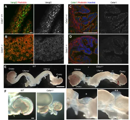 Fig. 3. Localization of PCP proteins and the morphology of oviducts and uteri in wild-type and Celsr1−/− mice