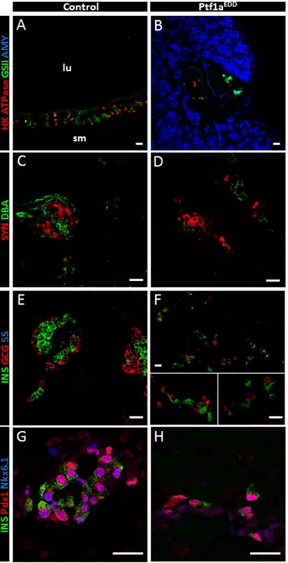 Fig. 4. Ectopic pancreas contains endocrine and exocrine cells.Doxycycline at E9.5, analysis at E18.5/P0