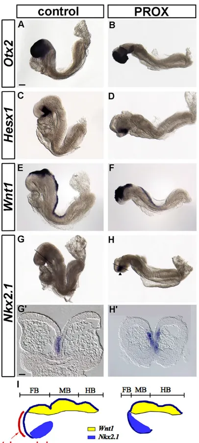 Fig. 4. Comparative gene expression analysis of the developing head incontrol and ablated mouse embryos.A-H; in Gexpression domains in control and PROX embryos