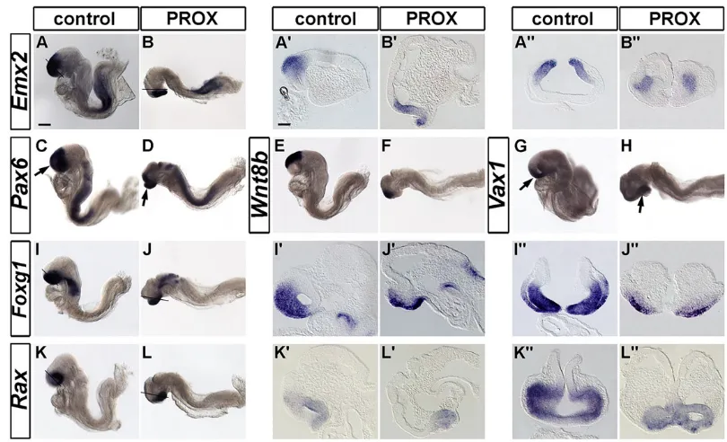 Fig. 5. Comparative analysis of forebrain marker expression in control and ablated mouse embryos