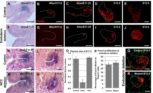 Fig. 6. Delayed Foxn1 expression and thymus hypoplasia after endoderm-specific deletion