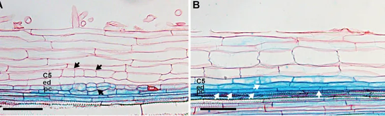 Fig. 2. MtENOD40::GUSare initiated on the same is a marker to distinguish between early lateral root primordium and nodule primordium