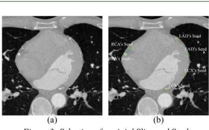Figure 3: Selection of an Axial Slice and Seed 