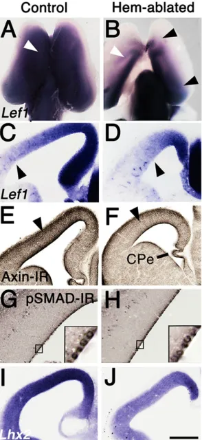 Fig. 1. Reduced indicators of WNT and BMP signaling in hem-ablatedcortex.Scale bar: in J, 400 µm for A,B; 200 µm for C-F,I,J; 50 µm for G,H