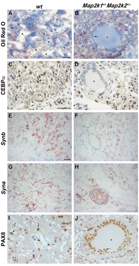 Fig. 2. Characterization of MTGs in placenta from E12.5 Map2k1notlipid droplets (arrow) was observed in MTGs (asterisk)