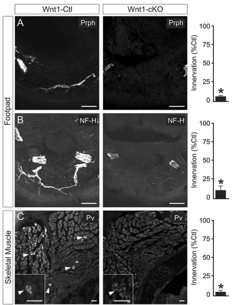 Fig. 5. Sympathetic target tissue innervation is impaired in Wnt1-Crehydroxylase (TH) immunohistochemistry showed target tissue innervationand visceral axon bundle branching abnormalities in newborn Wnt1-cKOcompared with+;Elp1f/f (Wnt1-cKO) mice