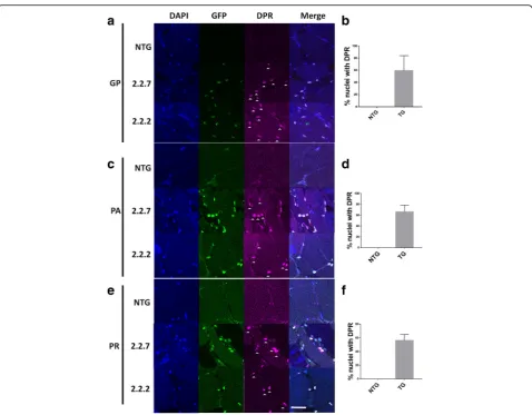 Fig. 2 C9orf72 model zebrafish display DPR expression in the nucleus. (images nuclei are stained with Hoechst (blue), GFP is stained with GFP antibody (green) and DPR proteins are stained with the relevant DPR antibody(purple), white arrow heads denote DPR