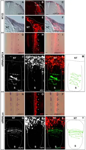 Fig. 3. GPC4 in neural crest cells regulates WNT11Luciferasedisorganization in the orientation of myocytes, which is not seenin the controls