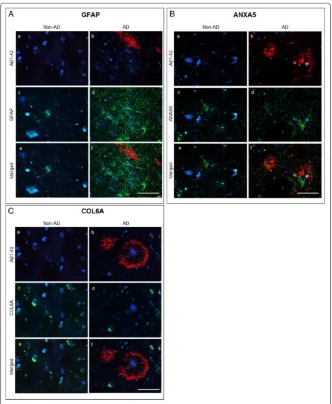 Fig. 4 Double immunofluorescence against ACalibration bars 50amygdala sections of human AD samples and non-AD samples, used to study the distribution of GFAP (green,(green,β1–42, and GFAP (A), Aβ1–42 and ANXA5 (B) and Aβ1–42 and COL6A (C)