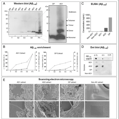 Fig. 1 Quantification and evaluation of the Abanalyzed with western blot and ELISA. SEM images of AD1 extracts (a, b), AD2 extracts (c, d), DP extracts (e, f), and non-AD extracts (g, h)