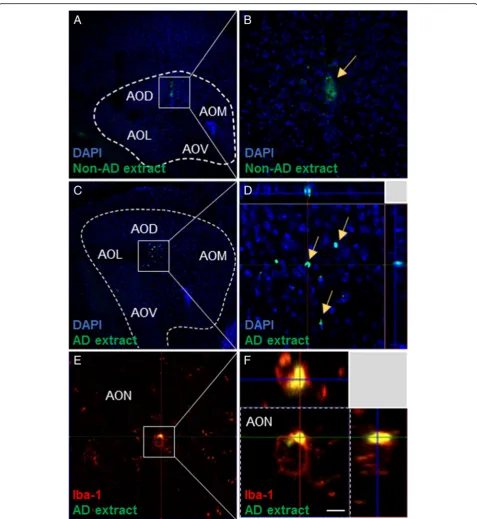 Fig. 3 Microinjection and internalization of Alabeled extracts were injected. Human non-AD extracts (β1–42 in the dorsal anterior olfactory nucleus