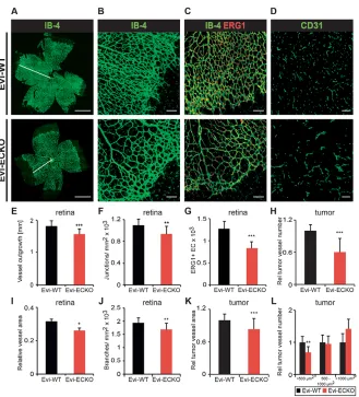 Fig. 1. Reduced retinal vascularization and ECnumber in Evi-ECKO mice.ERG1vessel number (H;(I; (A,B) Representativeimages of the total retinal vasculature (A) and thesprouting front (B) stained with IB-4 in Evi-WT andEvi-ECKO retinas