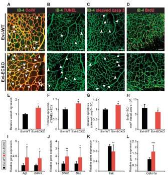 Fig. 2. Increased vessel regression in Evi-ECKOmice as a consequence of reduced survival and(E-H) Quantifications of relative vessel regression(E;retina area (F;caspase-3total number of BrdUproliferation