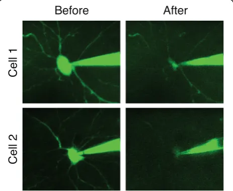 Fig. 3. Collapse of cell body during aspiration into patch pipette.Two example neurons patched in vivo under two-photon guidanceusing a green fluorescent dye in the patch pipette