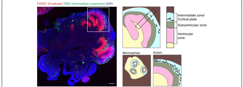 Fig. 10. Cerebral organoids model the architecture of the developing human brain. Left: a section of an entire cerebral organoid stained for theforebrain marker Foxg1, the intermediate progenitor marker Tbr2, and DAPI, revealing the presence of lobules of 