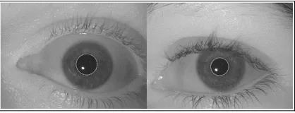 Figure 3:  Pupil Segmentation 