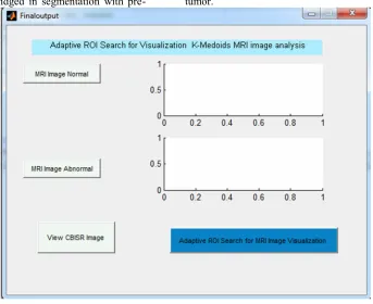 Table 2: Comparison Of The Clustering Segmentation