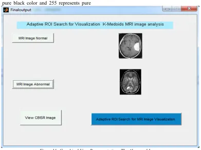Figure 10: Graphical User Representations The Normal Image.