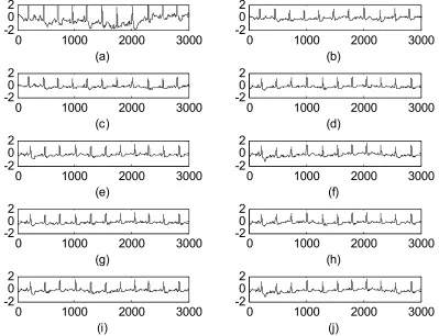 Table II. Fig. 6 shows the comparison of these 