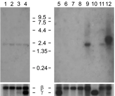 Figure 4Il4i1_2 lent to human exons 3 and 4 (red arrowheads in Fig. 1). The blots were reprobed for beta actin mRNA as control for RNA content