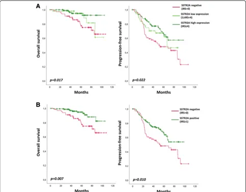 Fig. 4 Overall survival and Progression-free survival according to SSTR2A protein expression in anaplastic oligodendroglioma,b1p/19q-codeleted