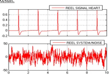 Table 4 Parameters Of  The  Disturbance Brain Generator Frequencies  Like A Reel Disturbances 