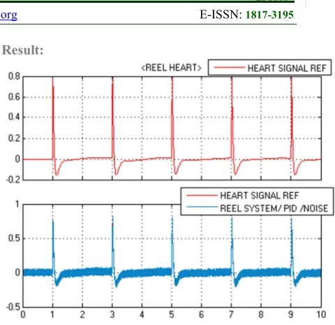 Fig 14  The Simulation of the heart without disturbance 