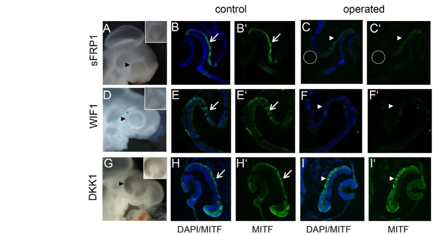 Fig. 4. Wnt signalling, but not Wnt/β(arrowheads) compared with the contralateral side (E,Ethe contralateral (H,Happears normal (arrowhead) compared with the contralateral eye (inset)