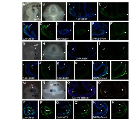 Fig. 6. Initiation of MITF expression requires the activation of both the BMP and Wnt/GSK3β signalling pathways