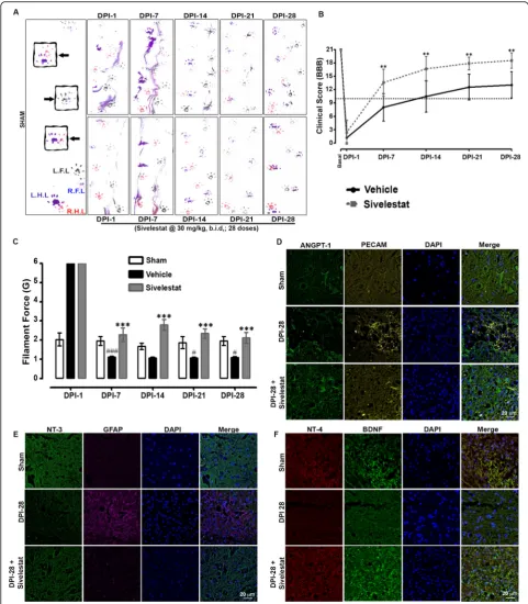 Fig. 8 Sivelestat treatment improved motor functions and attenuated neuropathic pain after spinal cord injury (SCI)