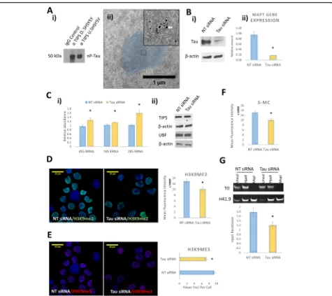 Fig. 2 Tau localises with TIP5 and impacts on rDNA transcription and heterochromatin. Immunoprecipitation from whole cell lysates showed thatthe knockdown cells showed a significant increase in 45S-pre-rRNA synthesis (rDNA transcription), 18S rRNA and 28S 