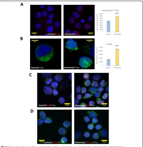 Fig. 4 Cellular stress induces nuclear accummulation of P-Tau which does not colocalise with nucleolar markers