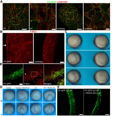 Fig. 5. FF ACs are underincreased tension and epiboly