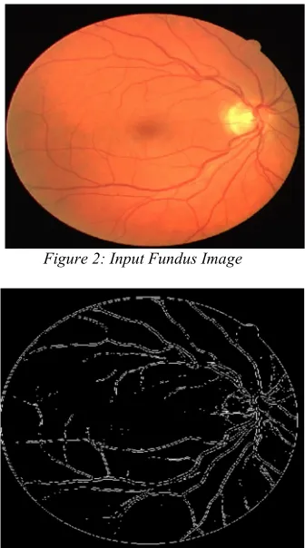 Figure 2: Input Fundus Image