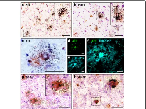 Fig. 5 Nuclear emulsion autoradiography with [18F]THK-5117 in the Alzheimer’s disease case AD1
