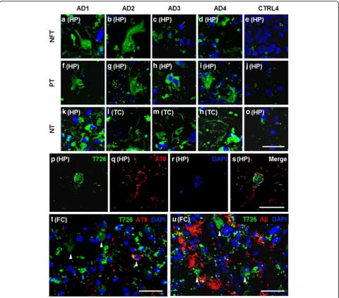 Fig. 2 Fluorescence imaging with T726 in Alzheimer’s disease cases and controls. a–o) T726 bound pathology in green, nuclear marker DAPI inblue; scale bar inset 50 μm