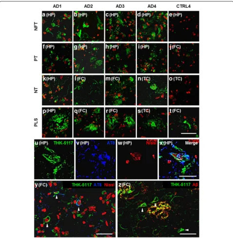 Fig. 3 Fluorescence imaging with THK-5117 in Alzheimerscale bar inset 50like structures; FC, frontal cortex; TC, temporal cortex; HP, hippocampus; ANissl Neurotrace 640, in red; scale bar inset 50immunofluorescence showing distinct and co-incidental bindin