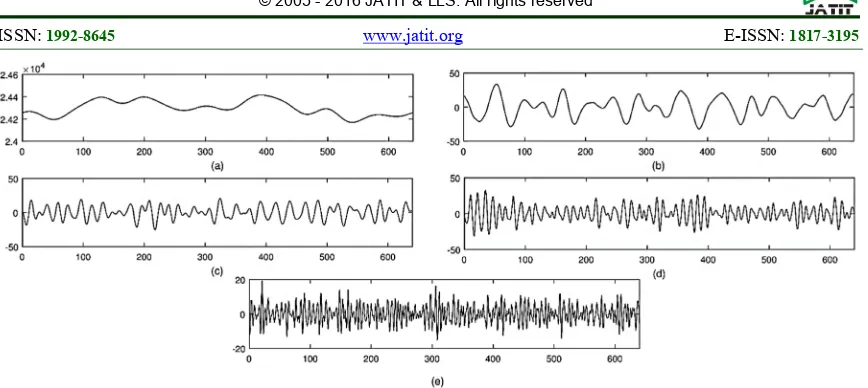 Figure 1. Brainwaves (a) Delta, (b) Theta, (c) Alpha, (d) Beta, (e) Gamma