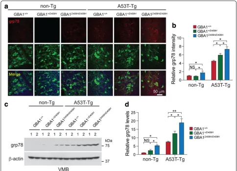 Fig. 7 D409H GBA1 expression shows early induction of ER chaperone grp78 in the A53T α-synuclein transgenic mice