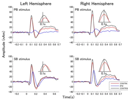 Figure 4Source waveforms elicited by right ear stimulationSource waveforms elicited by right ear stimulation