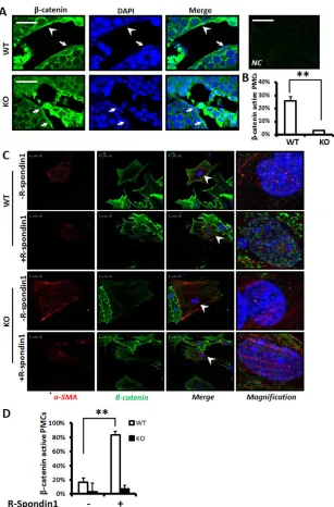 Fig. 6. Lgr4 is crucial for Wnt/β-catenin signalingactivation in PMCs. (A,B) Wnt/β-catenin signaling